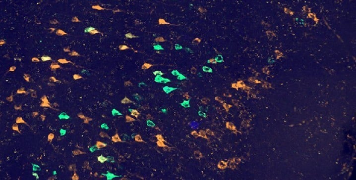 image confocale de neurones de projection du cortex insulaire