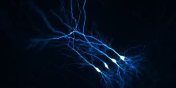 Figure 1 : CA1 neurons in a mouse organotypic hippocampal slice, that were single cell electroporated with TdTomato as a volume marker and observed by confocal microscopy at the Bordeaux Imaging Center.