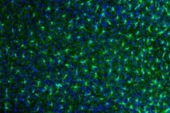 Microglial cells (green) and nuclei from microglial cells and other types of cells including neuronal cells (blue) © INRAE