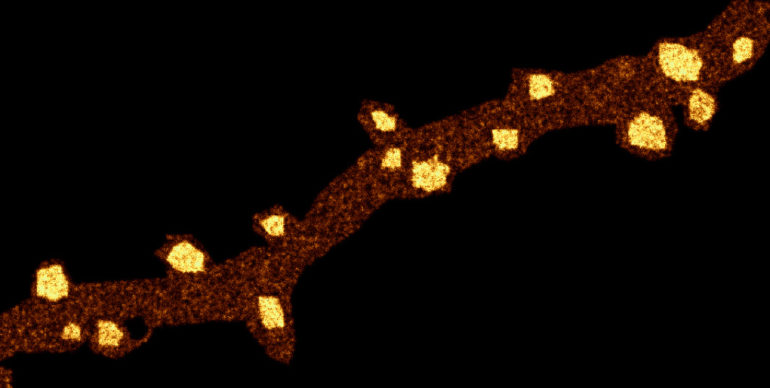 Simulated super-resolution image of a dendritic segment showing accumulation of membrane receptors in the post-synaptic densities.