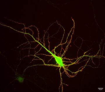 Live extracellular labeling of neosynthesized GluA1 90 minutes after release from the endoplasmic reticulum. Green: GluA1 in the endoplasmic reticulum, Red: externalized GluA1