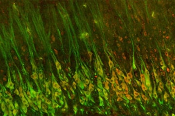 The Brain Prize Course: Movement and motor control in health and disease