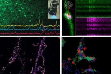 Cajal training – Advanced Imaging Techniques for Neuroscience
