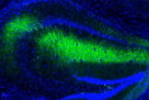 Maladies neurodégénératives : et si la clé se trouvait dans les mitochondries ?