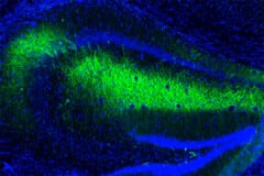 The expression and activation of mitoDREADD-Gs (green) in the hippocampus increases mitochondrial activity and restores memory in mouse models of dementia. © Rui Rodrigues/ Inserm © Rui Rodrigues/ Inserm