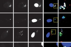Tuberculosis vulnerability of people with HIV: a viral protein implicated