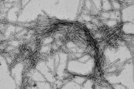 LIPAGG, un projet européen pour mieux comprendre la formation des fibres amyloïdes