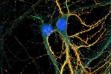 Sonia Poirault-Chassac sur le compte Instagram de l’Inserm