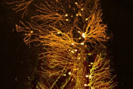 FENS–EJN Image Competition