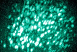 ieux comprendre comment nos émotions influencent nos décisions grâce au cortex préfrontal dorso-médian