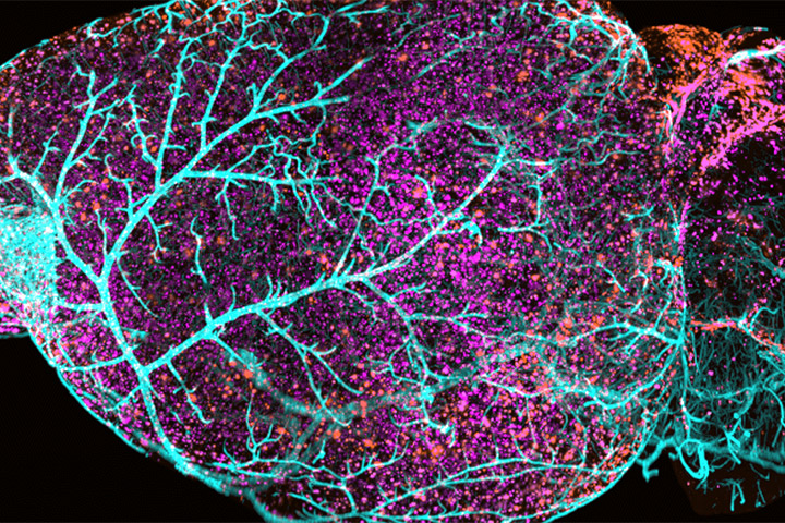 Cajal course - The Neurovascular Unit and Beyond