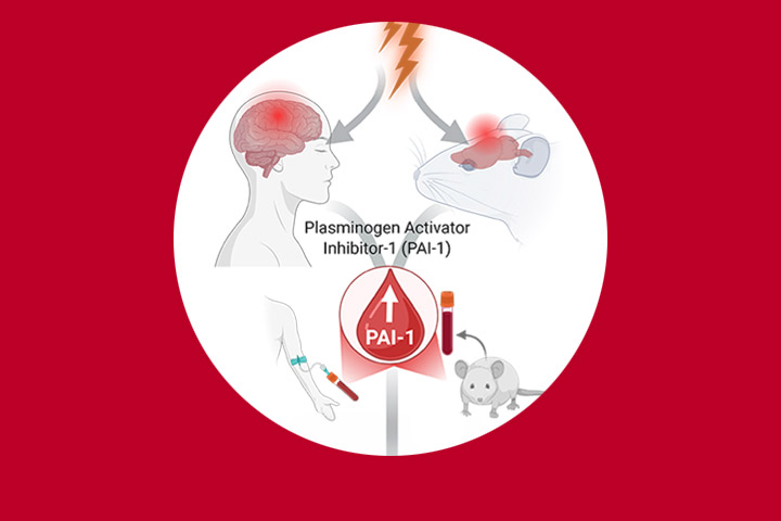 Le PAI-1 induit par le stress comme biomarqueur sanguin et facteur de risque cérébral du TSPT.