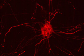 Des variants rares du gène PLCG2 qui multiplient le risque de développer la maladie d’Alzheimer